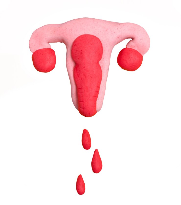 Abnormal Uterine Bleeding​
