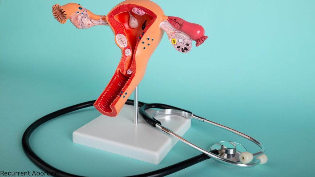 Abortion Treatment and Management Options